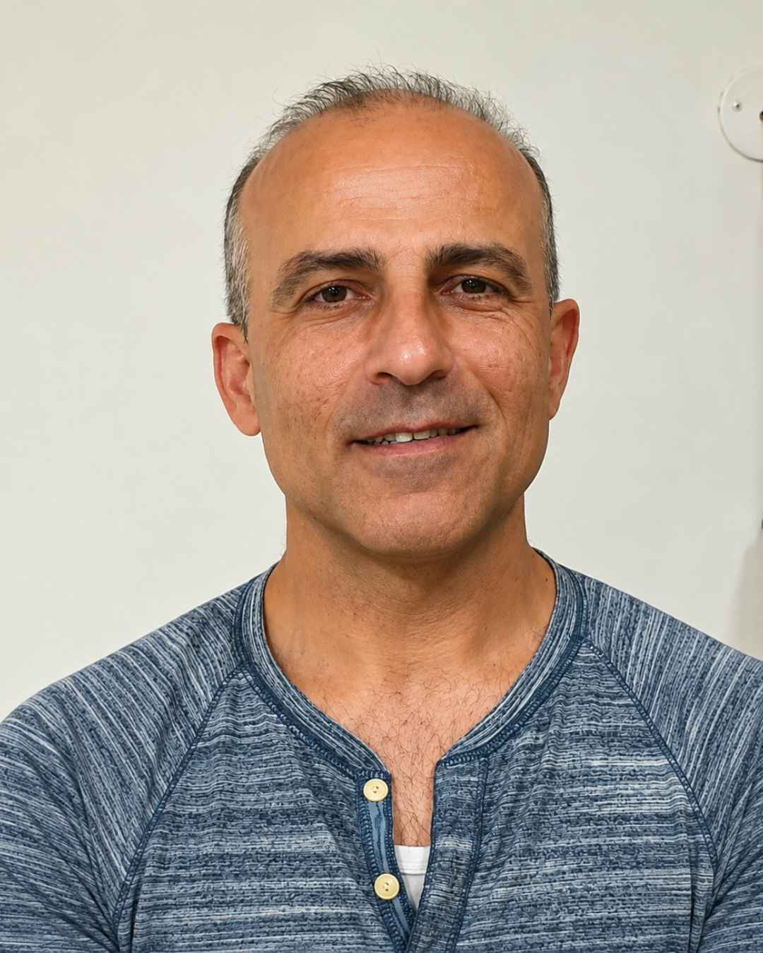 אלון שטשוילי עבודות שערים